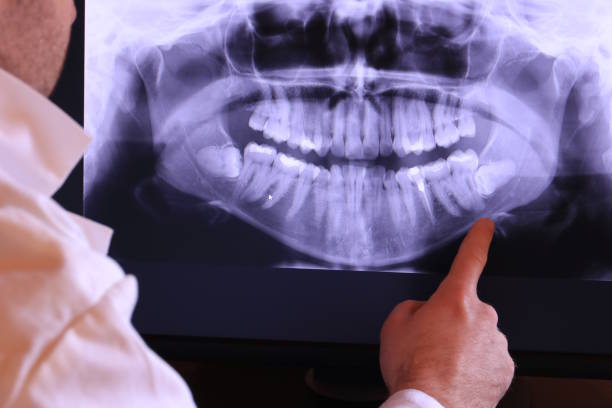 Best Walk-In Emergency Dentist in Fairfield, IL